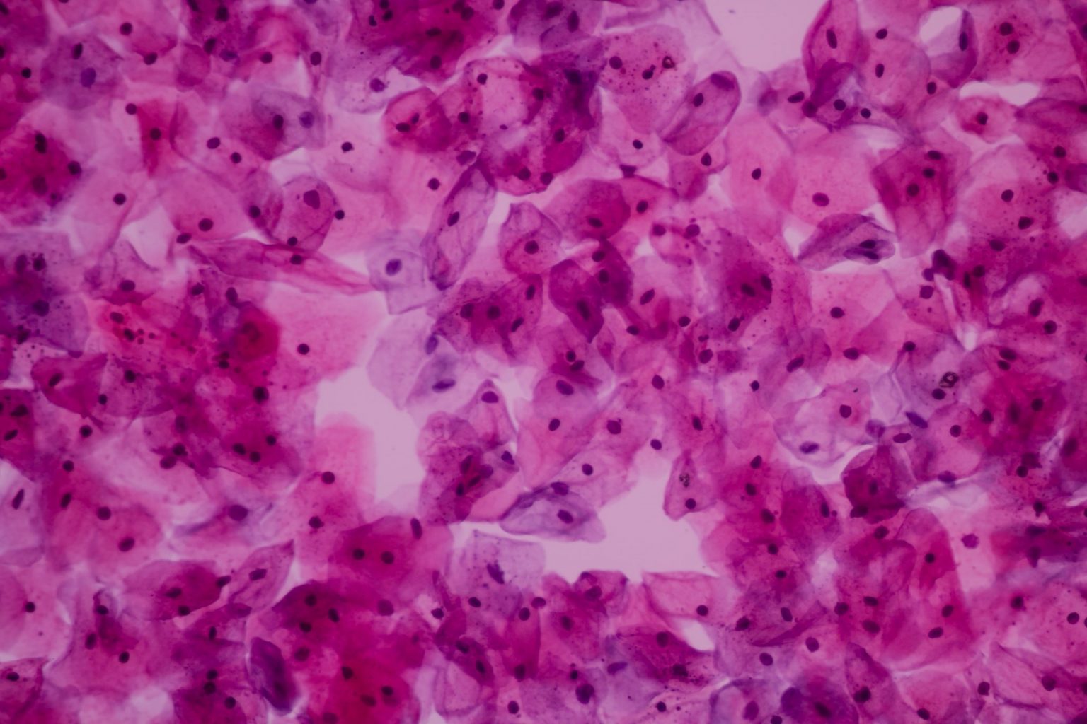 Vaginal cytology smear